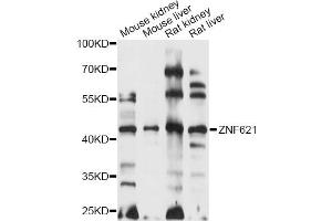 Western blot analysis of extracts of various cell lines, using ZNF621 antibody (ABIN6291114) at 1:1000 dilution. (ZNF621 antibody)