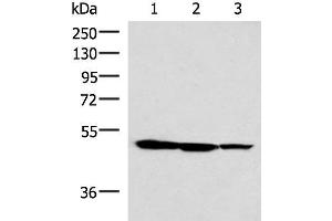 Western blot analysis of HepG2 K562 and A172 cell lysates using TTC38 Polyclonal Antibody at dilution of 1:1000