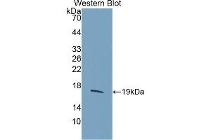 Figure. (HIST2H3A antibody  (AA 2-136))