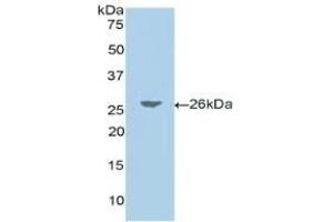Detection of Recombinant JAG1, Human using Polyclonal Antibody to Jagged 1 (JAG1) (JAG1 antibody  (AA 33-250))