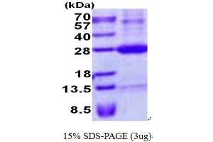 Retinoic Acid Early Transcript 1E (RAET1E) protein (His tag)