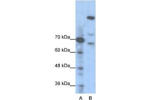 WB Suggested Anti-GLI1 Antibody Titration:  1.