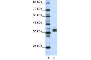 HNRPDL antibody used at 1 ug/ml to detect target protein. (HNRPDL antibody  (Middle Region))