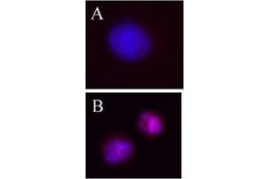 Image no. 1 for anti-Aurora Kinase B (AURKB) (pThr232) antibody (ABIN230502) (Aurora Kinase B antibody  (pThr232))