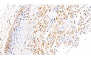 Detection of NODAL in Human Placenta Tissue using Polyclonal Antibody to Nodal Homolog (NODAL) (Nodal antibody  (AA 27-347))