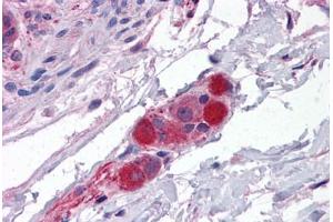 Human Small Intestine, Submucosal Plexus: Formalin-Fixed, Paraffin-Embedded (FFPE) (CDC42BPA antibody  (AA 2-14))