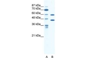 Western Blotting (WB) image for anti-Cation Channel, Sperm Associated 2 (CATSPER2) antibody (ABIN2461149) (CATSPER2 antibody)