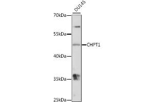 Western blot analysis of extracts of DU145 cells, using CHPT1 antibody (ABIN7266345) at 1:1000 dilution. (CHPT1 antibody  (AA 1-100))