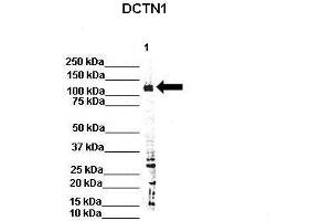 WB Suggested Anti-Dctn1 Antibody  Positive Control: Lane 1: 80ug rat brain extract Primary Antibody Dilution :  1:500 Secondary Antibody : IRDye 800 CW goat anti-rabbit from Li-COR Bioscience Secondry Antibody Dilution :  1:20,000 Submitted by: Dr. (Dynactin 1 antibody  (C-Term))
