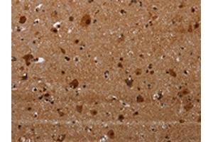 The image on the left is immunohistochemistry of paraffin-embedded Human brain tissue using ABIN7191356(MAGEE1 Antibody) at dilution 1/30, on the right is treated with synthetic peptide. (MAGEE1 antibody)