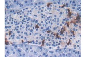 DAB staining on IHC-P; Samples: Human Pancreas Tissue (CXCL16 antibody  (AA 33-171))