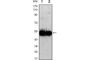 Western blot analysis using VCAM1 mouse mAb against HUVEC (1) and EC (2) cell lysate. (VCAM1 antibody)