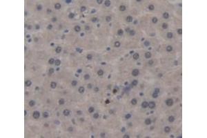 IHC-P analysis of Rat Tissue, with DAB staining. (Surfactant Protein C antibody  (AA 95-194))