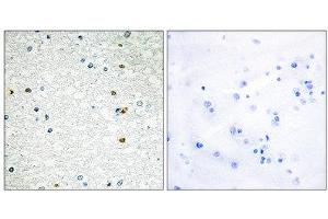 Immunohistochemistry (IHC) image for anti-Poly (ADP-Ribose) Polymerase Family, Member 3 (PARP3) (N-Term) antibody (ABIN1850493) (PARP3 antibody  (N-Term))