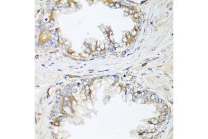Immunohistochemistry of paraffin-embedded human prostate using HPSE2 antibody at dilution of 1:100 (40x lens). (Heparanase 2 antibody)