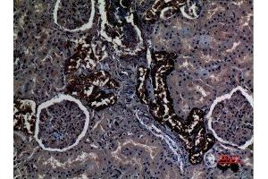 Immunohistochemistry (IHC) analysis of paraffin-embedded Human Kidney, antibody was diluted at 1:100. (RHCG antibody  (Internal Region))