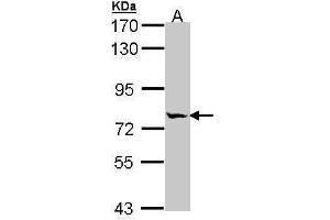 WB Image Sample (30 ug of whole cell lysate) A: A431 , 7. (MIPEP antibody)