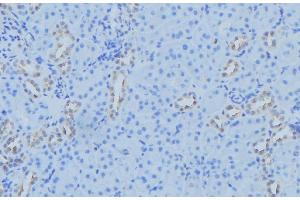 ABIN6279586 at 1/100 staining Mouse kidney tissue by IHC-P.