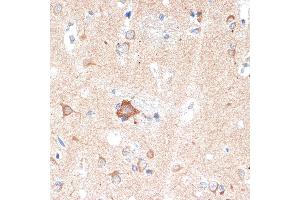 Immunohistochemistry (IHC) image for anti-Adenosine A1 Receptor (ADORA1) antibody (ABIN7265453)