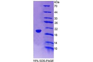 SDS-PAGE analysis of Human ICAM3 Protein.