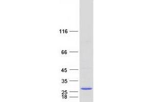 Validation with Western Blot (RER1 Protein (Myc-DYKDDDDK Tag))