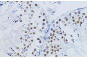 Immunohistochemistry of paraffin-embedded Rat testis using DiMethyl-Histone H3-K36 Polyclonal Antibody at dilution of 1:200 (40x lens).