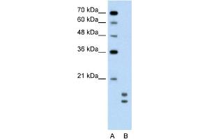 WB Suggested Anti-UBE2L3 Antibody Titration:  0. (UBE2L3 antibody  (C-Term))