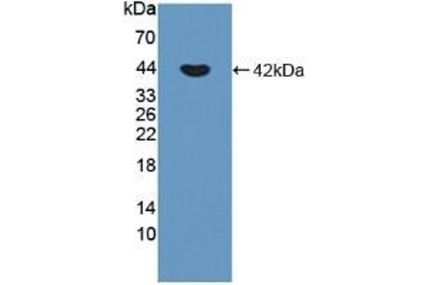 P-Cadherin 抗体  (AA 371-660)