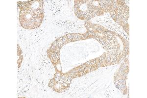 anti-Inositol 1,4,5-Trisphosphate Receptor, Type 3 (ITPR3) (AA 625-675) antibody