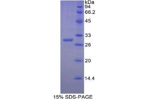 SDS-PAGE of Protein Standard from the Kit (Highly purified E. (CA2 ELISA Kit)
