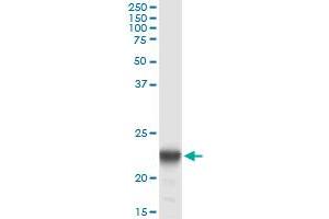 Immunoprecipitation of PMVK transfected lysate using anti-PMVK monoclonal antibody and Protein A Magnetic Bead , and immunoblotted with PMVK MaxPab rabbit polyclonal antibody. (PMVK antibody  (AA 1-192))
