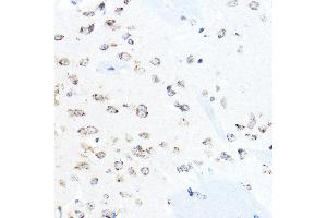 Immunohistochemistry (IHC) image for anti-Heat Shock Protein 90kDa beta (Grp94), Member 1 (HSP90B1) (AA 550-650) antibody (ABIN6142031)