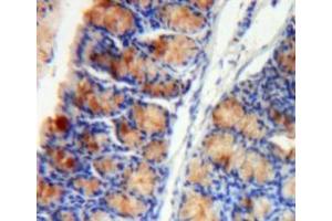 Immunohistochemistry (IHC) image for anti-Hypoxia Inducible Factor 1, alpha Subunit (Basic Helix-Loop-Helix Transcription Factor) (HIF1A) (AA 588-836) antibody (ABIN7432637)