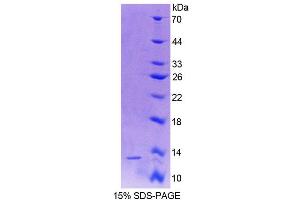 SDS-PAGE (SDS) image for Vitamin D-Binding Protein (GC) (AA 395-475) protein (His tag) (ABIN1171640) (Vitamin D-Binding Protein Protein (GC) (AA 395-475) (His tag))