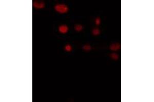 ABIN6274370 staining LOVO cells by IF/ICC. (TRIP13 antibody  (C-Term))