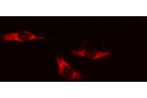 ABIN6274191 staining HeLa cells by IF/ICC. (Hexokinase 1 antibody  (N-Term))