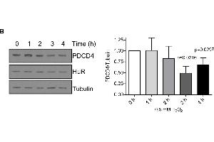 H2O2 causes cytoplasmic accumulation of HuR and a loss in PDCD4 expression that is mediated by miR-21A.