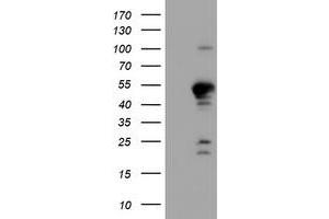 HEK293T cells were transfected with the pCMV6-ENTRY control (Left lane) or pCMV6-ENTRY PPP1R15A (Right lane) cDNA for 48 hrs and lysed. (GADD34 antibody)