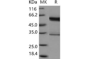 Plasminogen Activator, Tissue (PLAT) protein (Fc Tag)