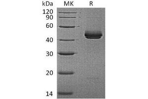 Western Blotting (WB) image for Interleukin 12 beta (IL12B) protein (His tag) (ABIN7320572) (IL12B Protein (His tag))