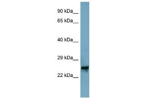 WB Suggested Anti-MRPL48 Antibody Titration: 0. (MRPL48 antibody  (Middle Region))