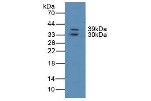 Figure. (LIPG antibody  (AA 175-412))