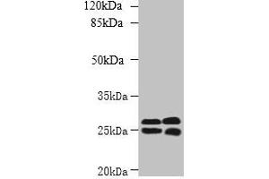 Western blot All lanes: CMBL antibody at 1 μg/mL Lane 1: Mouse kidney tissue Lane 2: Mouse liver tissue Secondary Goat polyclonal to rabbit IgG at 1/10000 dilution Predicted band size: 29 kDa Observed band size: 29, 25 kDa (CMBL antibody  (AA 2-245))