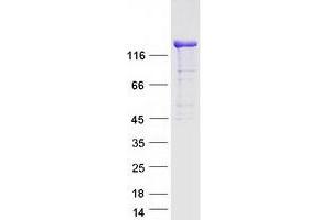 Validation with Western Blot (DIAPH1 Protein (Transcript Variant 2) (Myc-DYKDDDDK Tag))