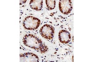 Immunohistochemistry (Paraffin-embedded Sections) (IHC (p)) image for anti-Ring-Box 1, E3 Ubiquitin Protein Ligase (RBX1) (AA 74-108), (C-Term) antibody (ABIN1944784)