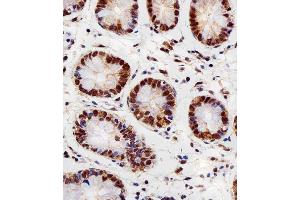 Immunohistochemical analysis of paraffin-embedded H. (RBX1 antibody  (C-Term))