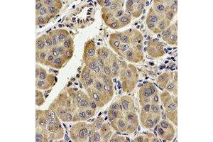 Immunohistochemical analysis of TECR staining in human liver formalin fixed paraffin embedded tissue section. (TECR antibody  (C-Term))