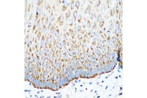 Immunohistochemistry of paraffin-embedded human esophagus using MT-CO2 antibody (ABIN5997496) at dilution of 1/100 (40x lens).