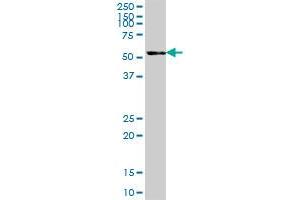 TBCE MaxPab polyclonal antibody. (TBCE antibody  (AA 1-527))