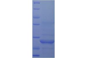 LRP4 Protein (AA 1747-1905) (His tag)